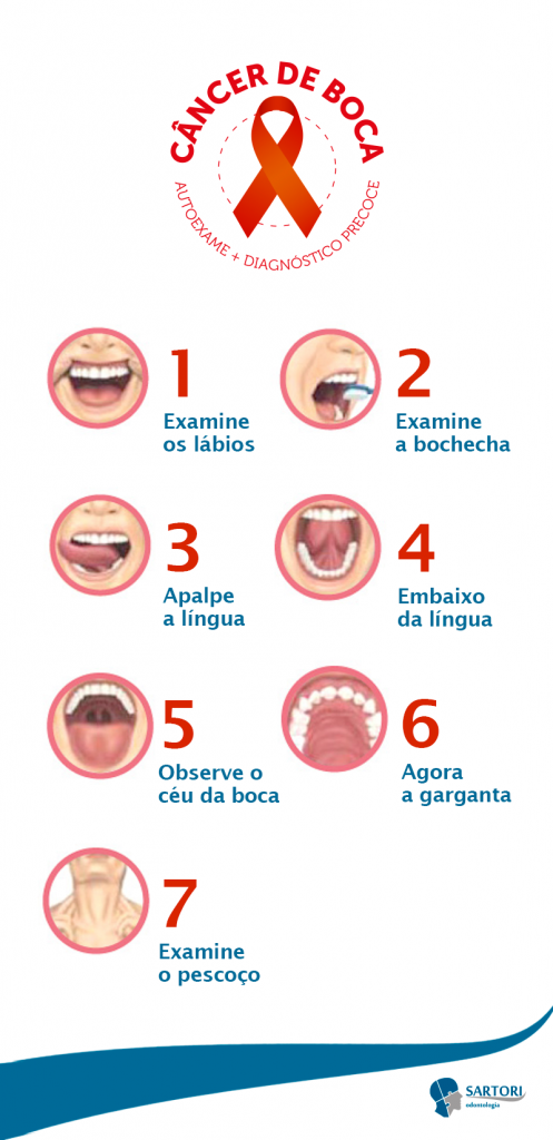 INFOGRAFICO